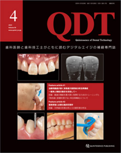 QDT