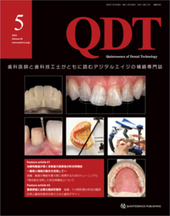 QDT