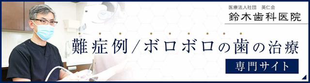 難症例 ボロボロの歯の治療
