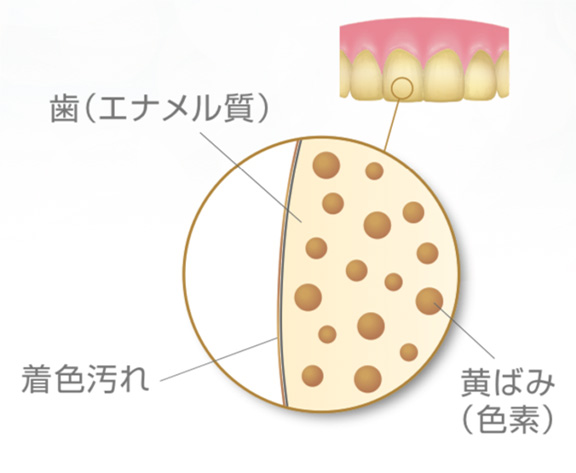 ホワイトニング前