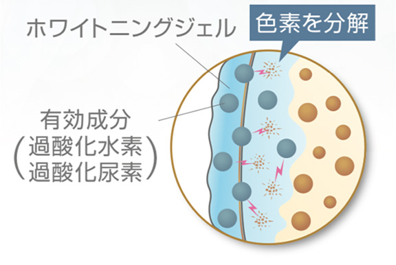 ホワイトニングジェルによる色素の分解